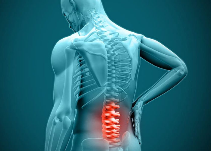 دیسک کمر چه علائمی دارد؟